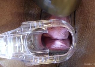 Inside Medical Play: Sensuality, Speculum & Sounding